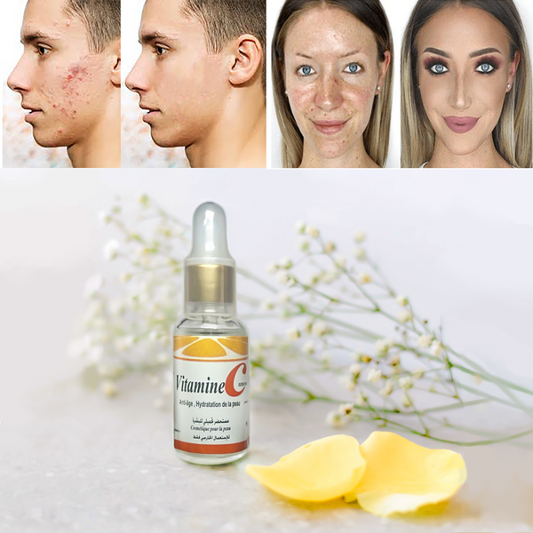 Serum 30ml مزيل الحبوب و الأتر
